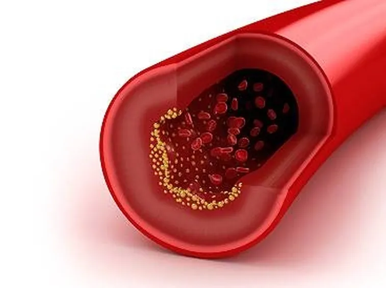 arteria